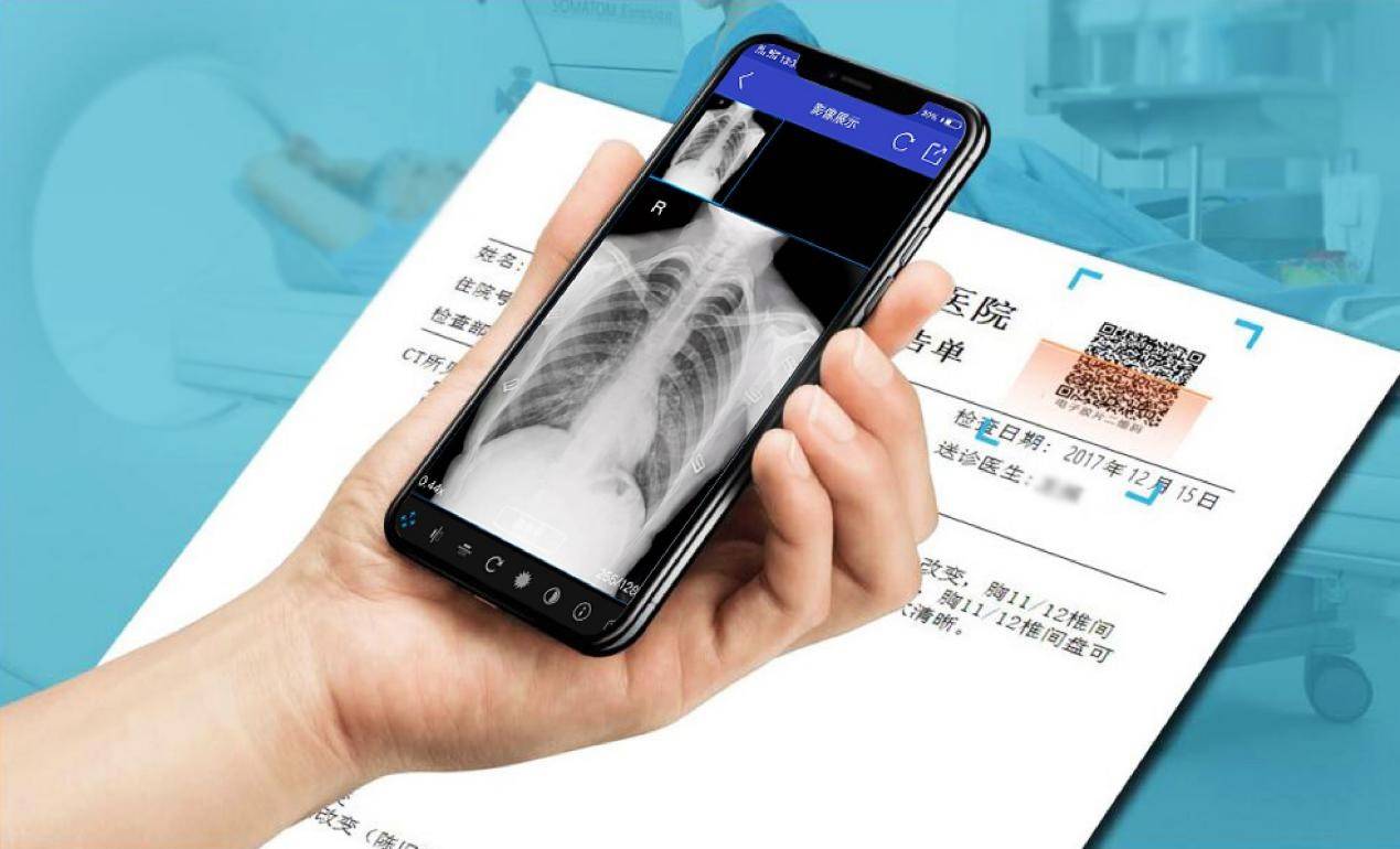 云膠片是什么？